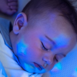 What can help a baby with eczema sleep