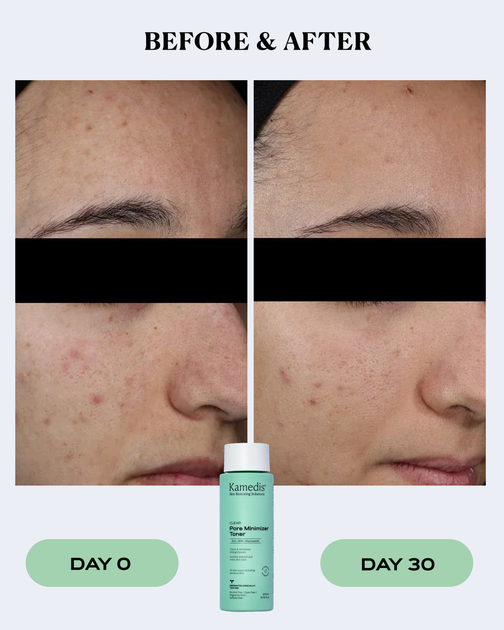 Pore Minimizer Toner | CLEAR
