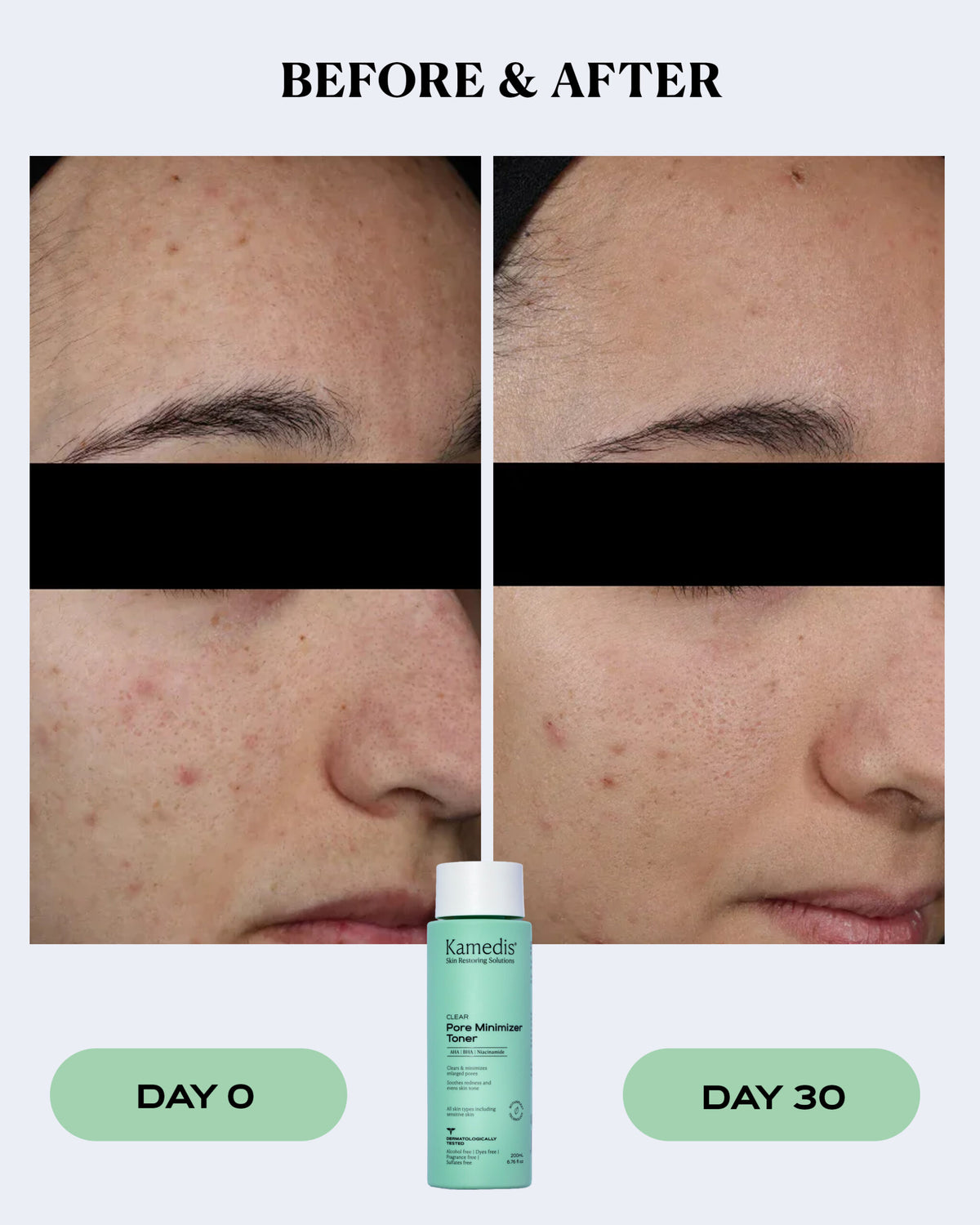 Pore Minimizer Toner | CLEAR