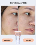 Redness Relief Cream | SEBO CONTROL