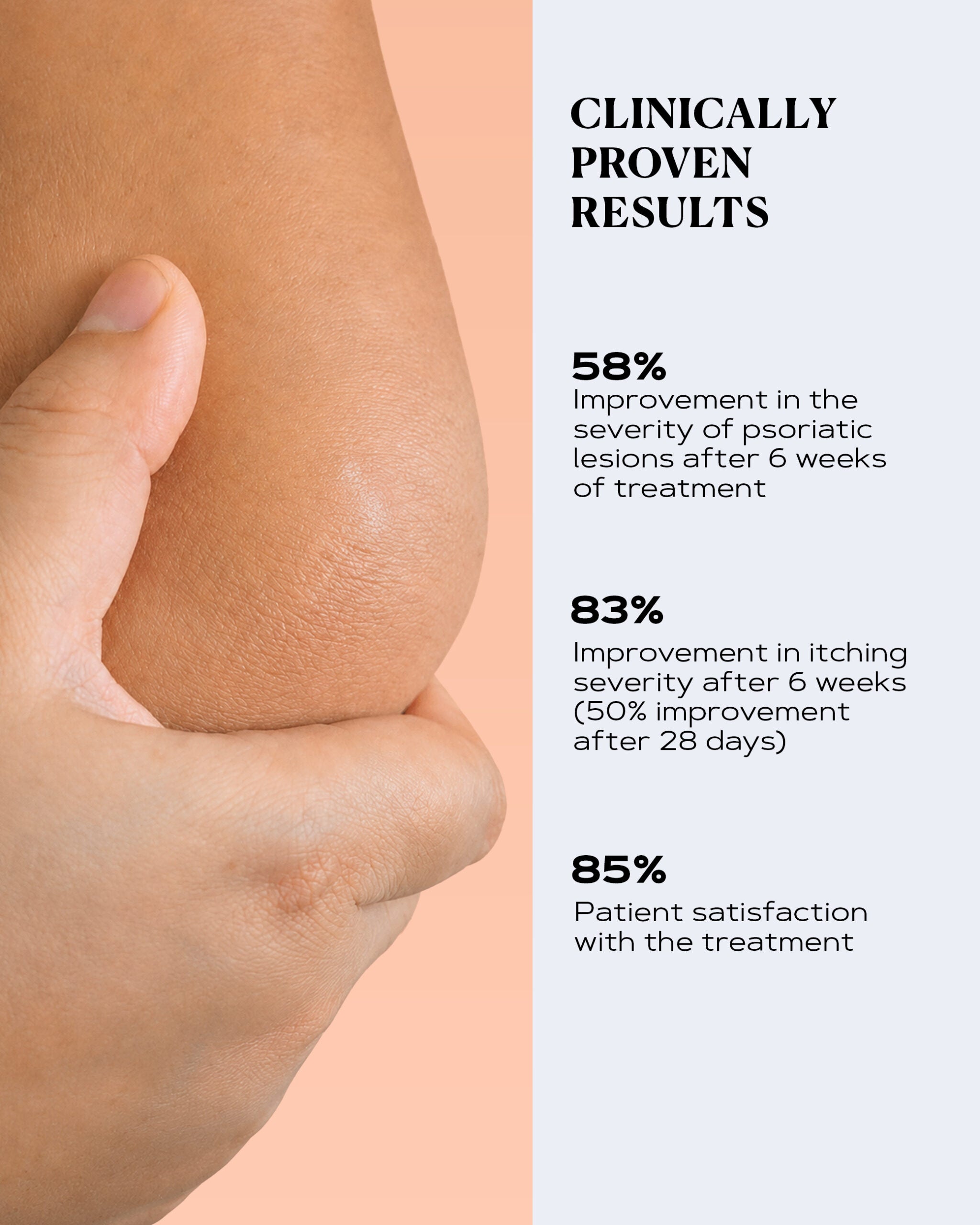 Rich Body Cream for Dry and Scaly Skin | PSO CONTROL