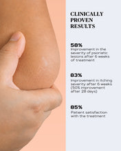 Load image into Gallery viewer, Rich Body Cream for Dry and Scaly Skin | PSO CONTROL
