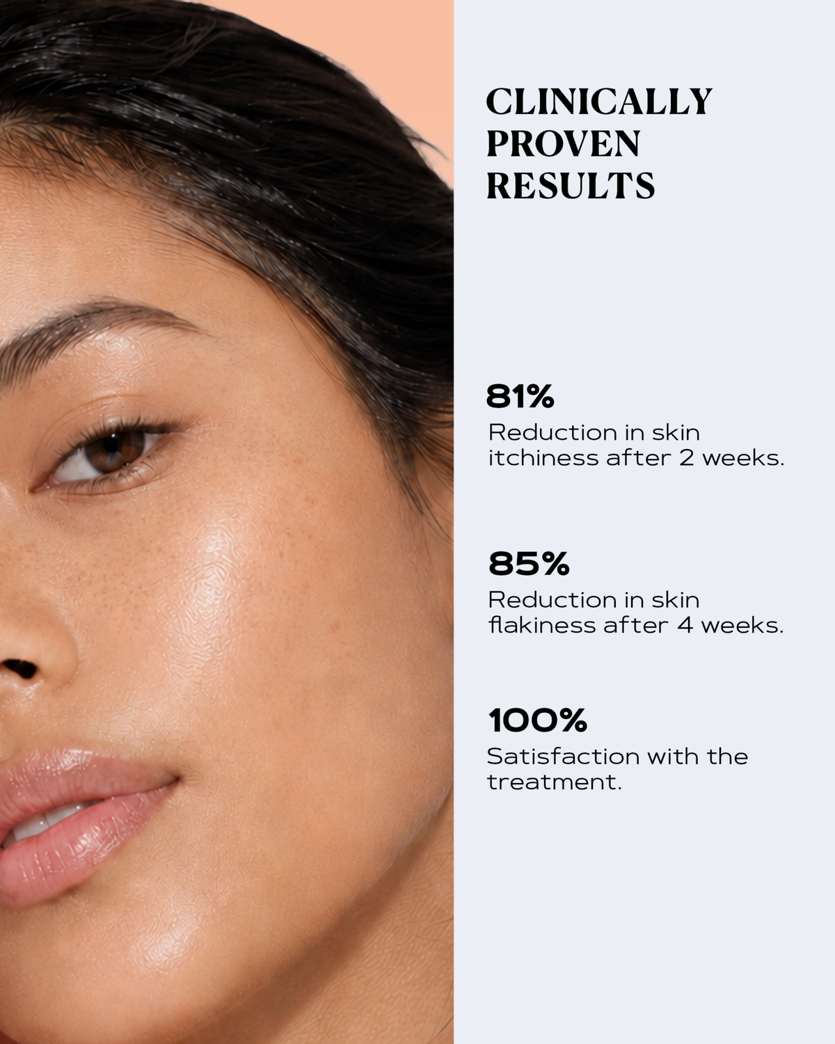 Redness Relief Cream | SEBO CONTROL