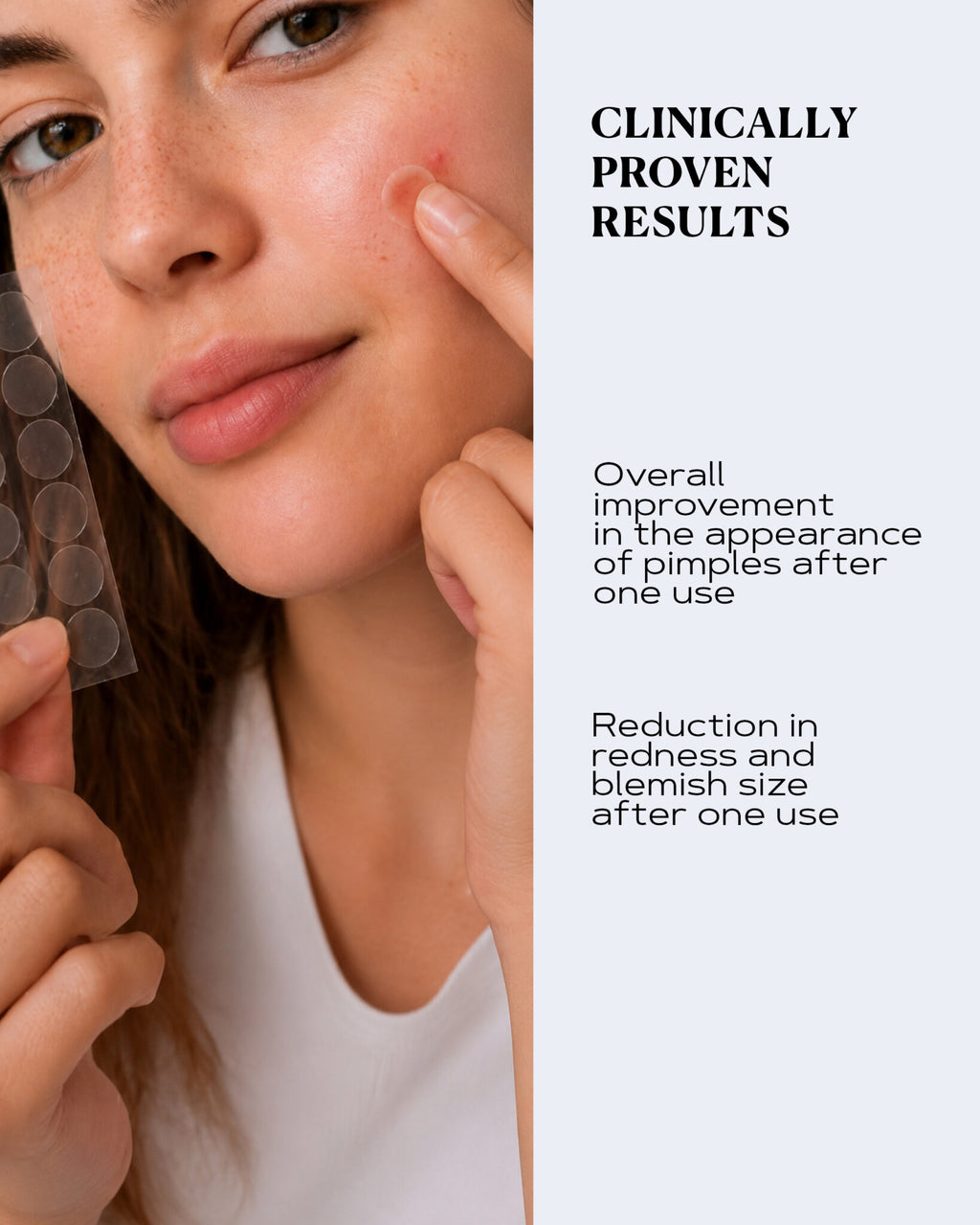 Transparent Pimple Patches for Fast Blemish Relief | CLEAR