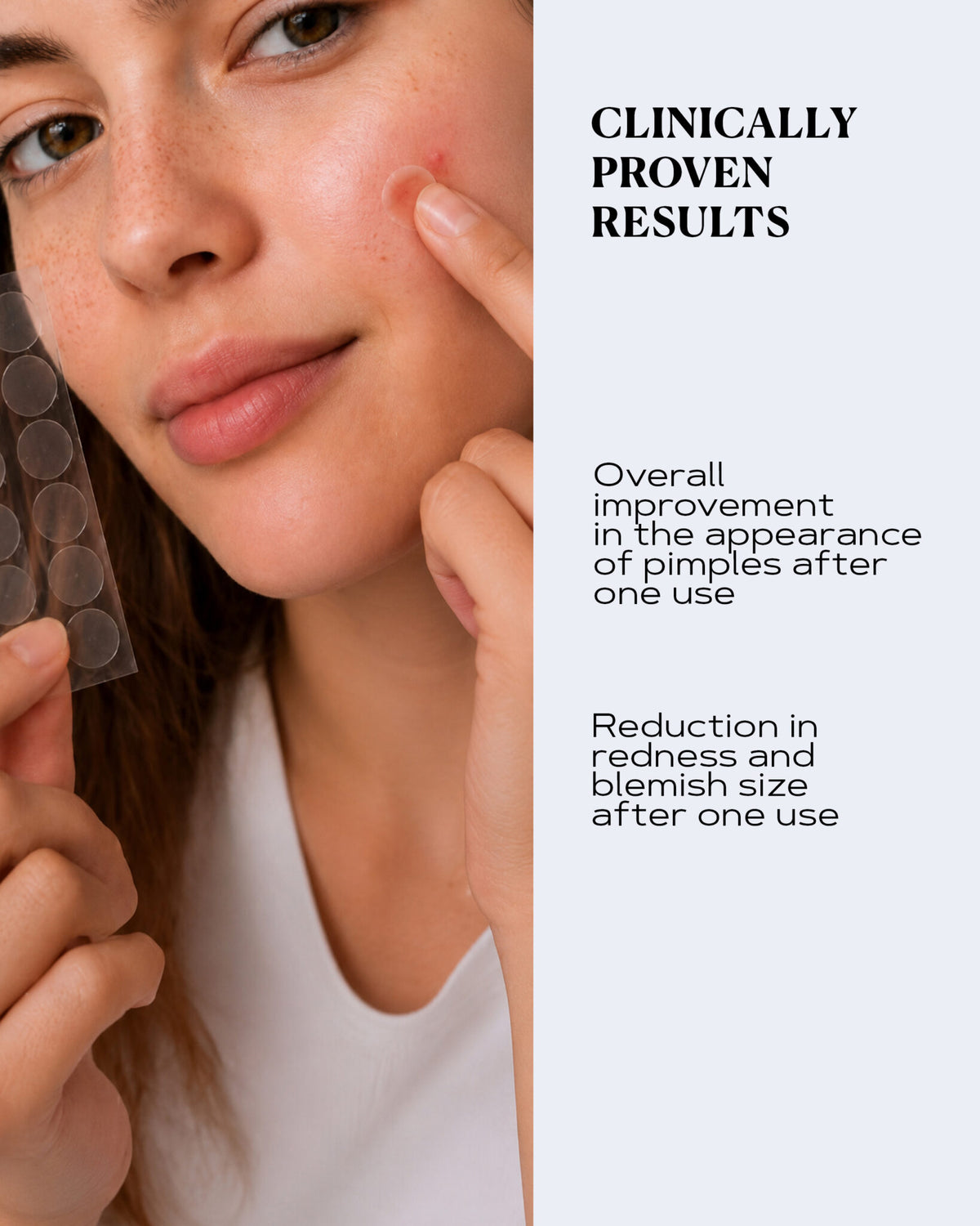 Transparent Pimple Patches for Fast Blemish Relief | CLEAR