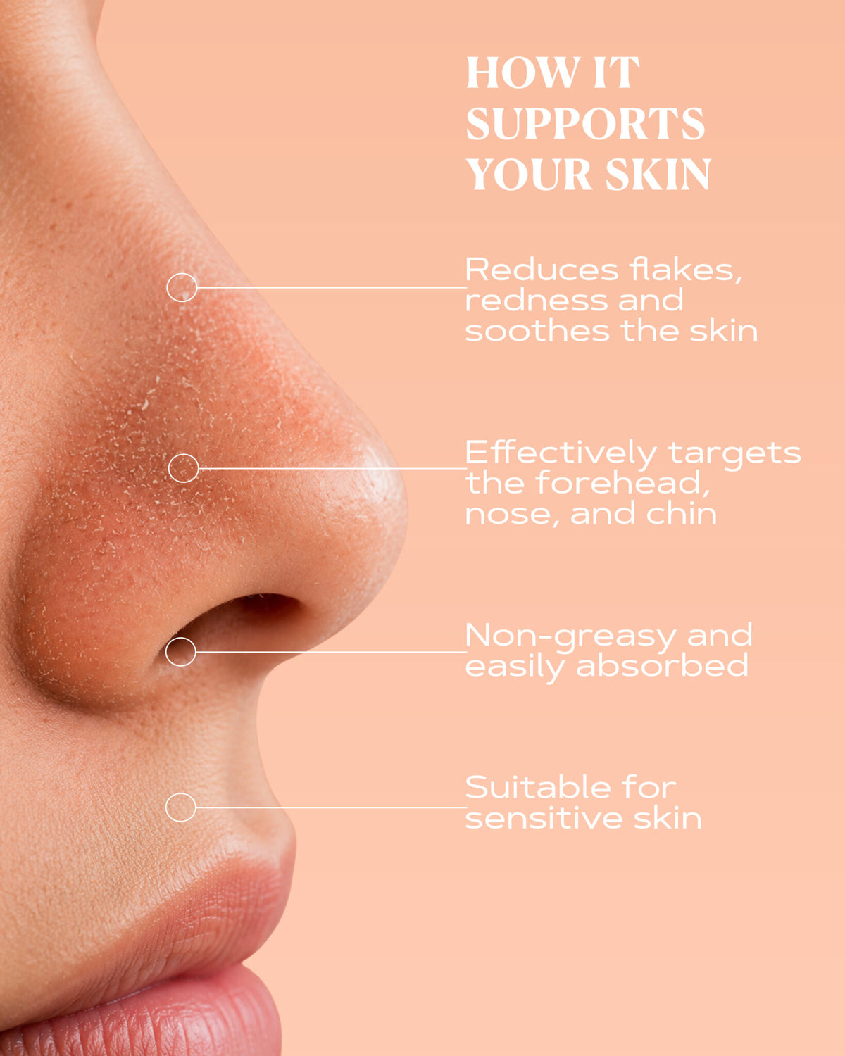 Redness Relief Cream | SEBO CONTROL