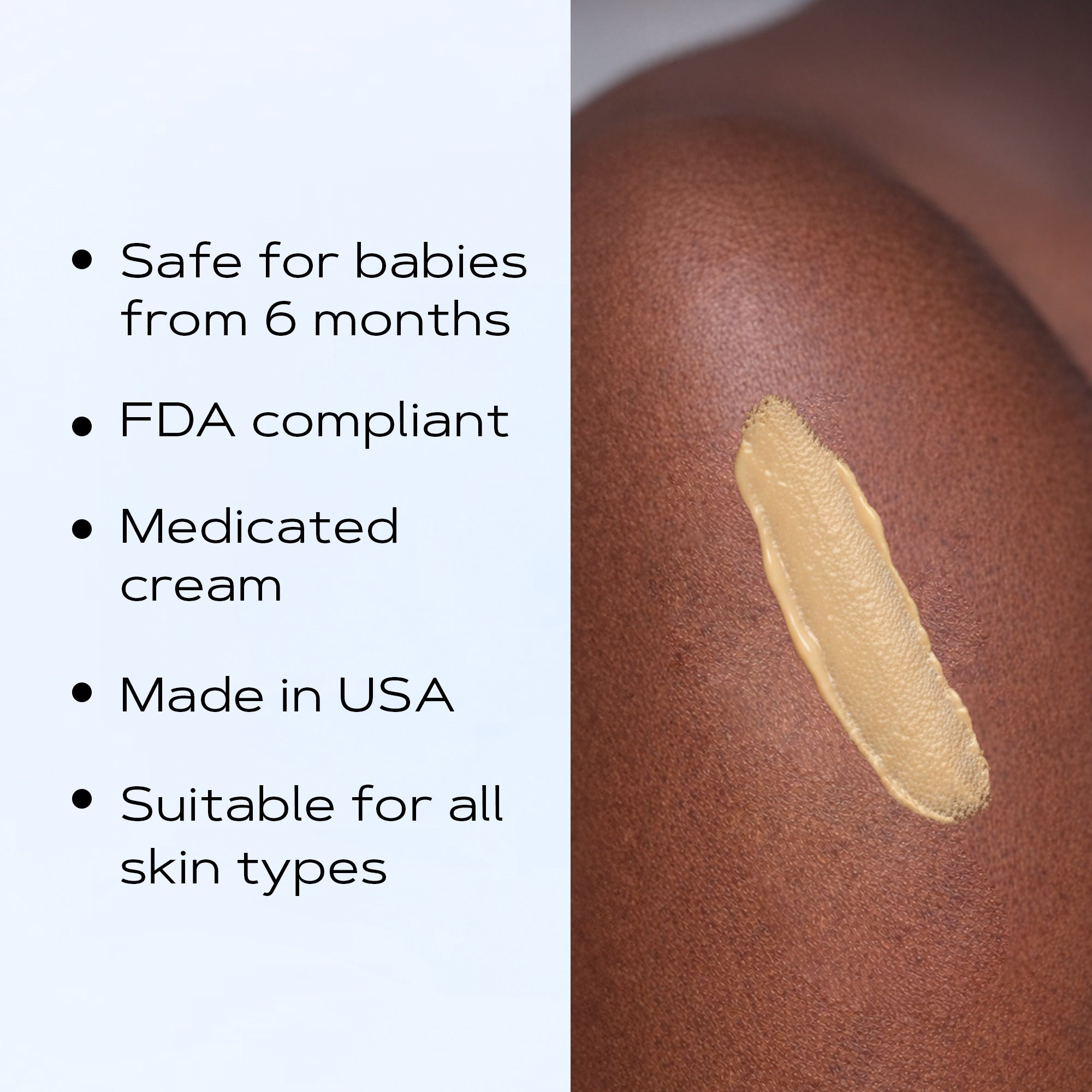 Eczema Therapy Cream