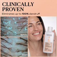 Load image into Gallery viewer, 3 Anti Dandruff Shampoo Saving pack | SCALP CONTROL
