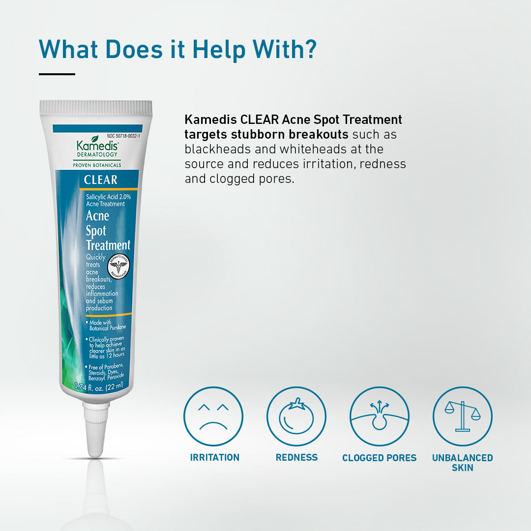 Acne Kit - Banish Blemishes (TO ACTIVATE IF NEEDED)